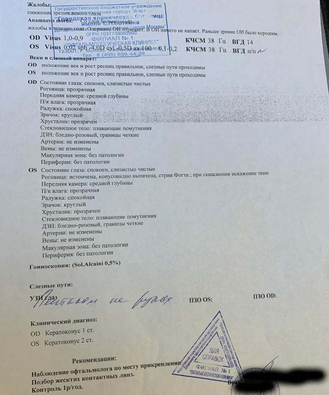 Лечение кератокоунса 1-2 степени в Москве - варианты и стоимость
