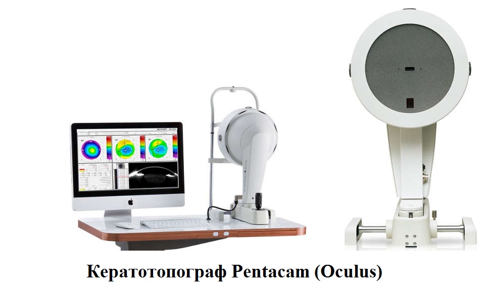 Кератотопограф Oculus Pentacam (Окулус Пентакам)