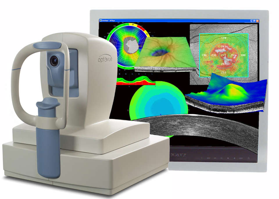 Оптический когерентный томограф в диагностике кератоконуса
