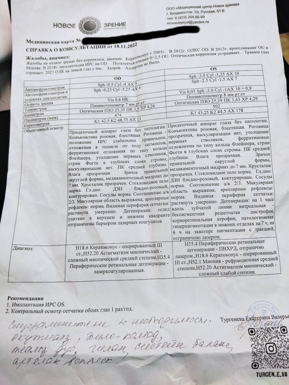 Ухудшение зрения при кератоконусе (был кросслинкинг)