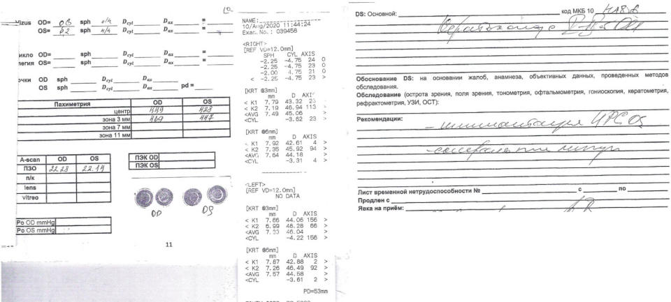 Лечение кератоконуса в Москве у иногороднего пациента