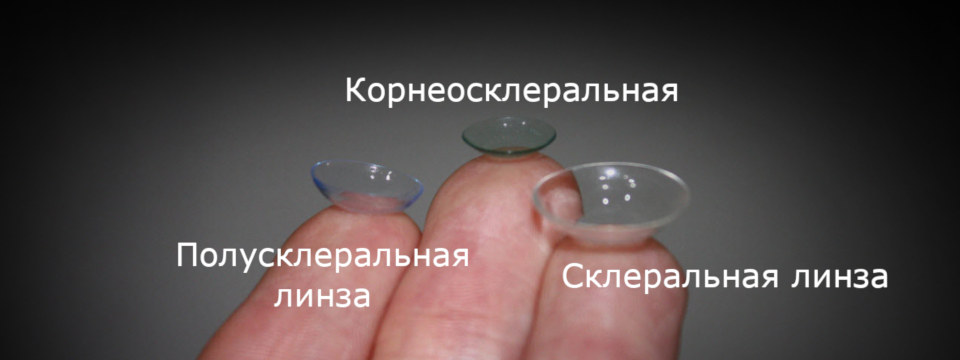 Подбор склеральных линз при кератокоунсе в Москве всех видов